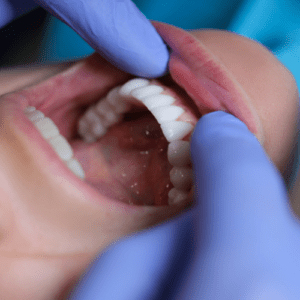 Close-up view of a person's mouth and teeth during a dental check-up