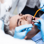 Close-up of a root canal procedure