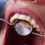 A preventive and routine care dental examination