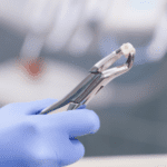 Close-up of tooth extraction forceps